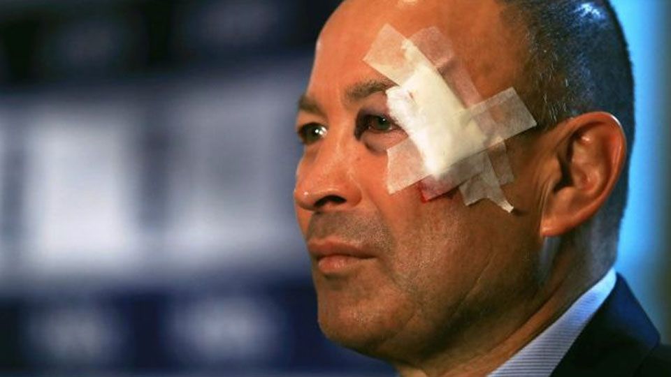 Pelatih Timnas Rugby Inggris asal Australia, Eddie Jones mengalami luka pada bagian wajahnya. Copyright: © smh.com